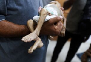 Gaza’s Children Are Dying of Hunger – And It’s Entirely Preventable